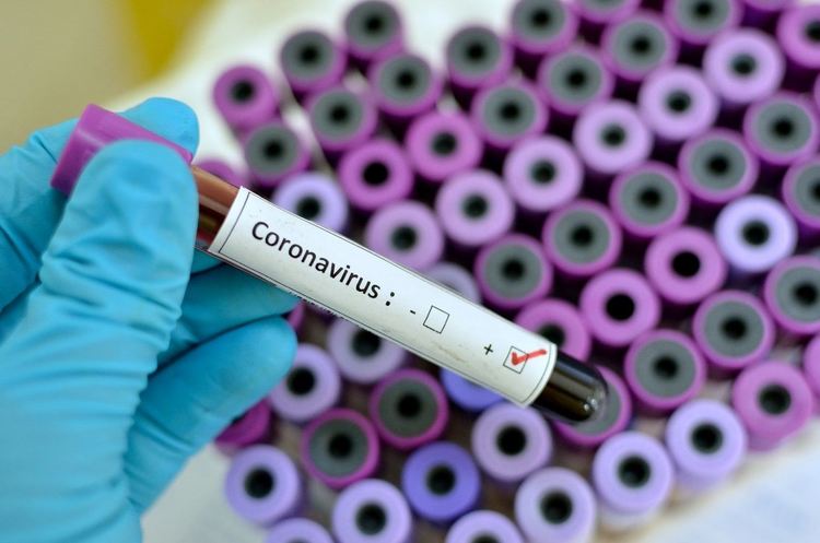 Двата нови случаи на COVID-19 в Кюстендил са пациенти, лекувани в столични болници